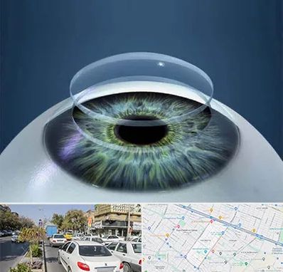 پیوند قرنیه در مفتح مشهد