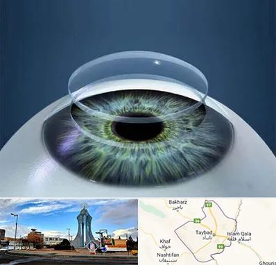 پیوند قرنیه در تایباد