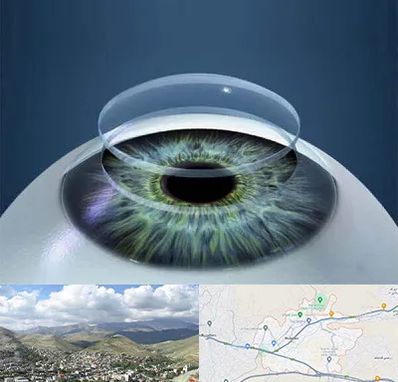 پیوند قرنیه در رودهن