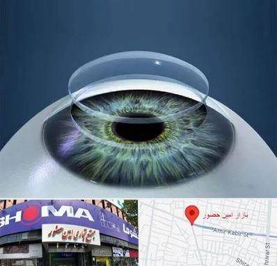 پیوند قرنیه در امین حضور