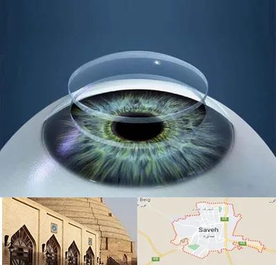 پیوند قرنیه در ساوه