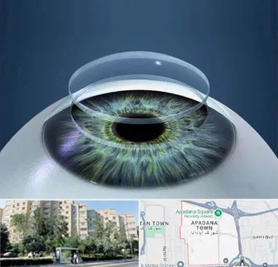 پیوند قرنیه در آپادانا