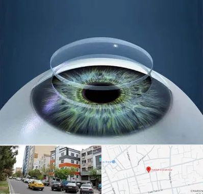 پیوند قرنیه در هفده شهریور تبریز