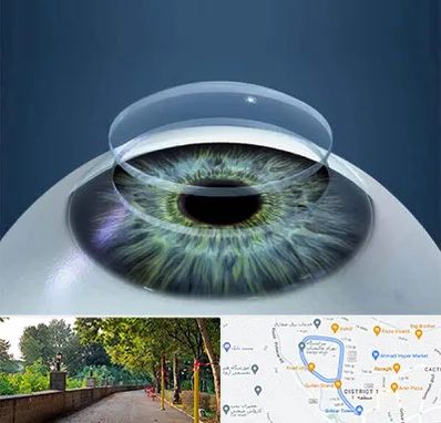 پیوند قرنیه در بلوار گیلان رشت