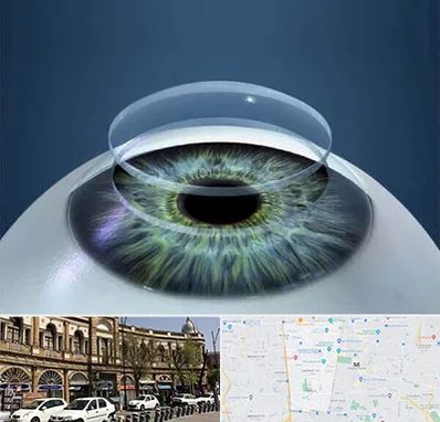 پیوند قرنیه در منطقه 11 تهران 