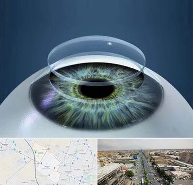 پیوند قرنیه در حصارک کرج