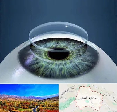 پیوند قرنیه در خراسان شمالی