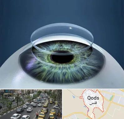 پیوند قرنیه در شهر قدس