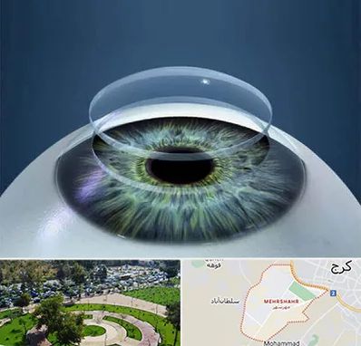 پیوند قرنیه در مهرشهر کرج 