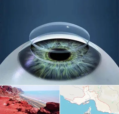 پیوند قرنیه در هرمزگان