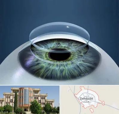 پیوند قرنیه در دهدشت