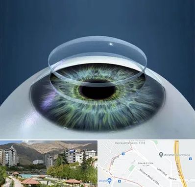 پیوند قرنیه در شهر زیبا 