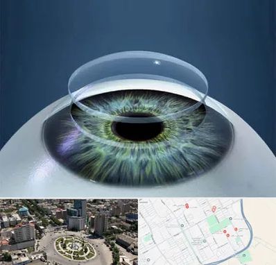 پیوند قرنیه در زرافشان اسلامشهر