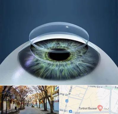 پیوند قرنیه در تربیت تبریز