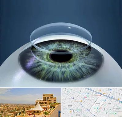 پیوند قرنیه در هاشمیه مشهد