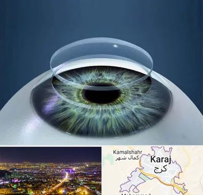 پیوند قرنیه در کرج