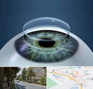 پیوند قرنیه در مهرویلا کرج