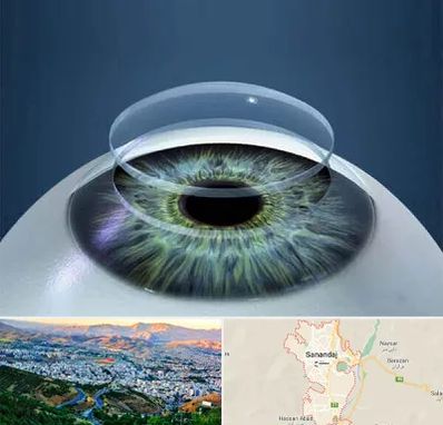 پیوند قرنیه در سنندج