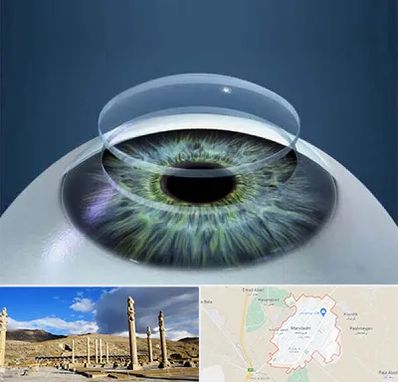 پیوند قرنیه در مرودشت