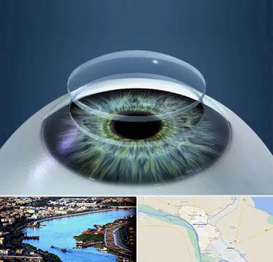پیوند قرنیه در خرمشهر