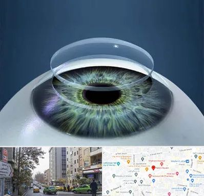 پیوند قرنیه در فاطمی 