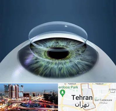 پیوند قرنیه در صادقیه 