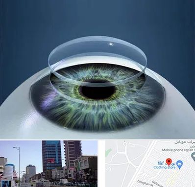 پیوند قرنیه در چهارراه طالقانی کرج