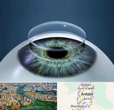 پیوند قرنیه در اردبیل