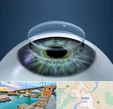 پیوند قرنیه در دزفول