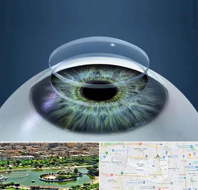 پیوند قرنیه در منطقه 9 تهران 