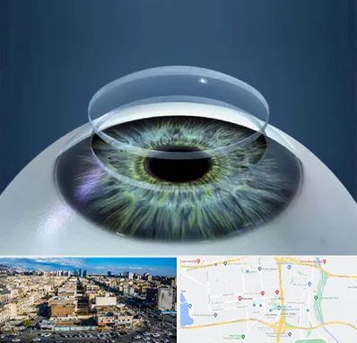 پیوند قرنیه در شهرک راه آهن