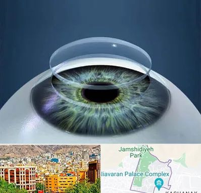 پیوند قرنیه در نیاوران 