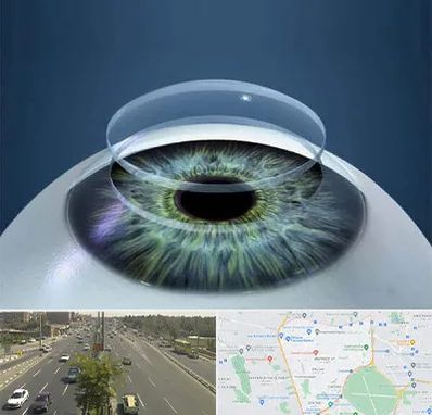 پیوند قرنیه در منطقه 17 تهران 