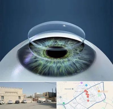 پیوند قرنیه در نواب اسلامشهر