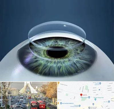 پیوند قرنیه در خیابان آزادی 