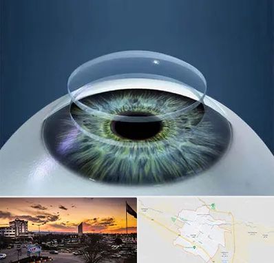 پیوند قرنیه در قوچان