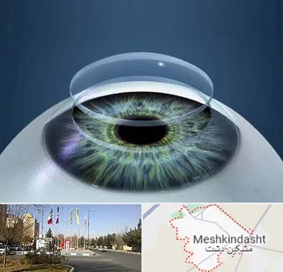 پیوند قرنیه در مشکین دشت