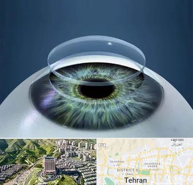 پیوند قرنیه در شمال تهران 
