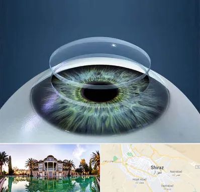 پیوند قرنیه در شیراز