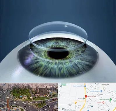 پیوند قرنیه در سبلان 