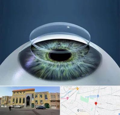 پیوند قرنیه در زنبیل آباد قم