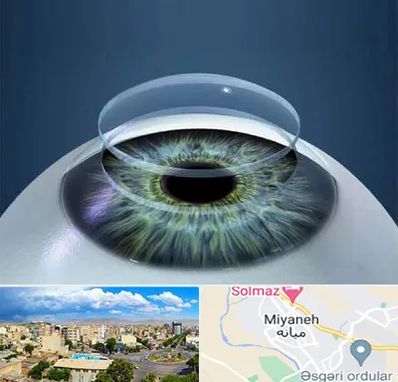 پیوند قرنیه در میانه