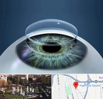 پیوند قرنیه در آرژانتین