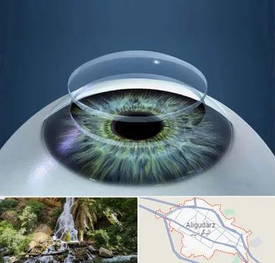 پیوند قرنیه در الیگودرز