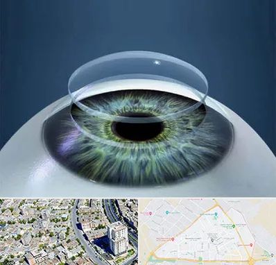 پیوند قرنیه در قاسم آباد مشهد 