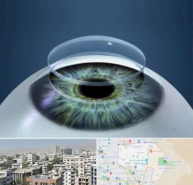 پیوند قرنیه در منطقه 14 تهران 