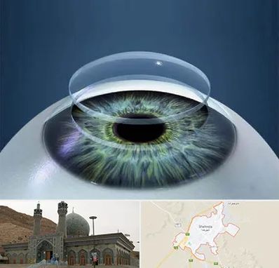 پیوند قرنیه در شهرضا