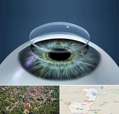 پیوند قرنیه در دماوند