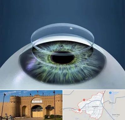 پیوند قرنیه در ایرانشهر
