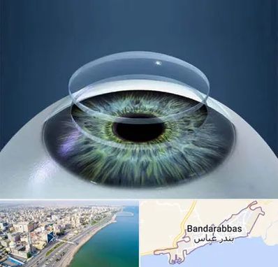 پیوند قرنیه در بندرعباس